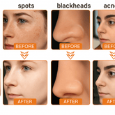 Hoygi Tear Mask – Soin Visage Complet & Éclat Naturel - stock limité - NatuRose naturose.store